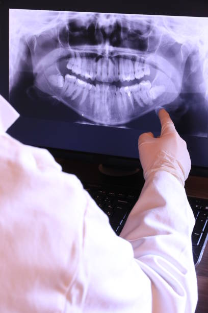 Best Dental Abscess Treatment in La Blanca, TX
